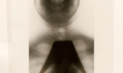 Peça em destaque: Imagem radiográfica